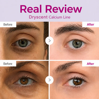 🔥LAST DAY 50% OFF!!Dryscent Korean Calcium Dark Spot Eye Cream